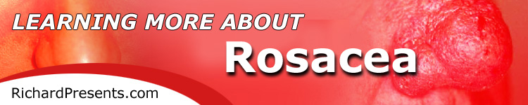 Rosacea | Site Map